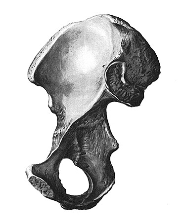 Подвздошная кость (os ilium)