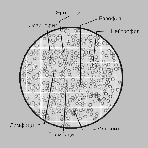 КРОВЬ В СЧЕТНОЙ КАМЕРЕ (под микроскопом). Счетная камера представляет собой специально разграфленное гладкое стеклышко. Разбавленную кровь капают в камеру и исследуют под микроскопом. Подсчет эритроцитов ведут в маленьких квадратиках, лейкоциты считают в больших квадратах. Затем вычисляют число клеток на единицу объема крови и определяют, есть ли отклонения концентрации каких-либо из них по отношению к норме.