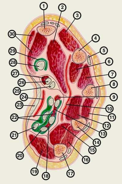 Рис. 3. Поперечный разрез правой кисти на уровне пястья: 1 — первая пястная кость; 2 — мышца, приводящая большой палац; 3 — первая тыльная межкостная мышца; 4 — вторая пястная кость; 5 — сухожилие разгибателя пальцев; 6 — ладонная межкостная мышца; 7 — вторая тыльная межкостная мышца; 8 — третья пястная кость; 9 — червеобразная мышца; 10 — глубокая ладонная дуга; 11 — третья тыльная межкостная мышца; 12 — вторая ладонная межкостная мышца; 13 — червеобразная мышца; 14 — четвертая пястная кость; 15 — ладонная межкостная мышца; 16 — четвертая тыльная межкостная мышца; 17 — пятая пястная кость; 18 — червеобразная мышца: 19 — мышцы возвышения мизинца; 20 — сухожилия глубокого сгибателя пальцев; 21 — сухожилия поверхностного сгибателя пальцев; 22 — общее синовиальное влагалище сгибателей пальцев; 23 — ладонный апоневроз; 24 — поверхностная ладонная дуга; 28 — сухожилие поверхностного сгибателя пальцев; 28 — сухожилие глубокого сгибателя пальцев; 27 — червеобразная мышца; 28 — сухожилие длинного сгибателя большого пальца; 29 — влагалище сухожилия длинного сгибателя большого пальца; 30 — мышцы возвышения большого пальца. Зеленым цветом обозначены влагалища сухожилий и линии суставов между костями запястья