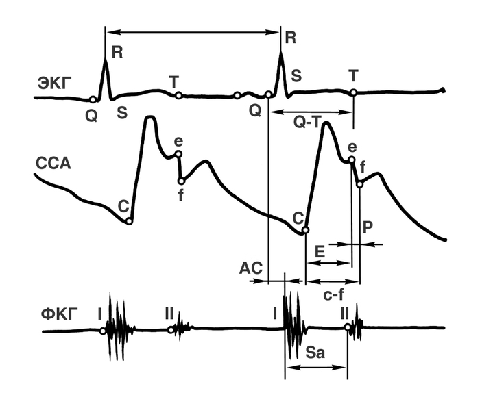 Рис. 2. Основные элементы нормальной поликардиограммы. На электрокардиограмме (ЭКГ): Q, R, S, Т — основные <a href=