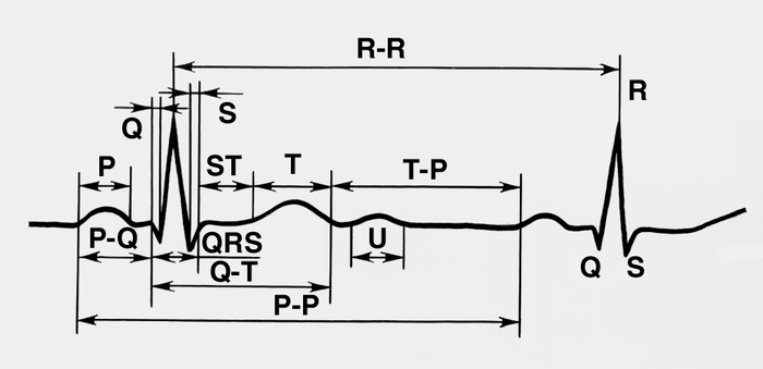 Рис. 4. Схематическое изображение нормальной электрокардиограммы: Р — зубец, отражающий ход распространения возбуждения по предсердиям; интервал Р-Q — время от начала возбуждения предсердий до начала возбуждения желудочков; интервал Q-Т — время электрической систолы желудочков, включающей распространение возбуждения по желудочкам сердца — комплекс QRS, сегмент RST и зубец Т; волна U, которая в норме наблюдается не всегда; R-R (Р-Р) — межцикловой интервал; Т-Р — диастолический интервал