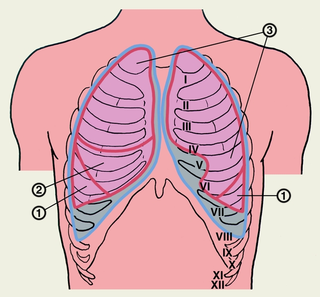 Рис. 1а). Проекция границ легких, их долей (красная линия) и париетальной плевры (синяя линия) на скелет грудной клетки (вид спереди): 1 — нижние доли правого и левого легкого; 2 — средняя доля правого легкого; 3 — верхние доли правого и левого легкого; римскими цифрами обозначены ребра