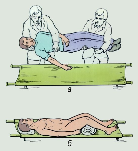 Рис. 2. Этапы укладывания пострадавшего с переломом костей таза для последующей транспортировки