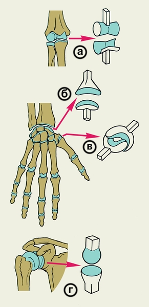 Рис. 1. Схематическое изображение суставов с различной формой суставных поверхностей: а — блоковидный сустав; б — эллипсовидный сустав; в — седловидный сустав; г — шаровидный сустав